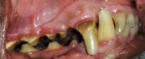 Tartar build up on dog's teeth